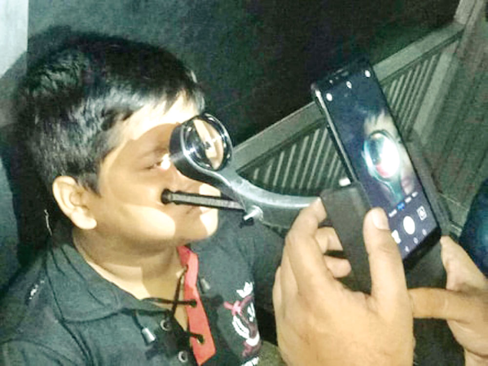 চোখের রেটিনা পরীক্ষায় 'স্মার্টফোন'