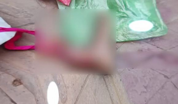 রাজধানীতে বাসের মধ্যে মিলল কাটা পা
