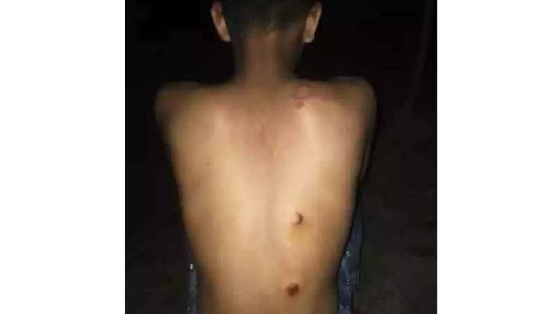 কালিহাতীতে স্কুল ছাত্রকে হাতুড়ি পিটিয়ে আহত