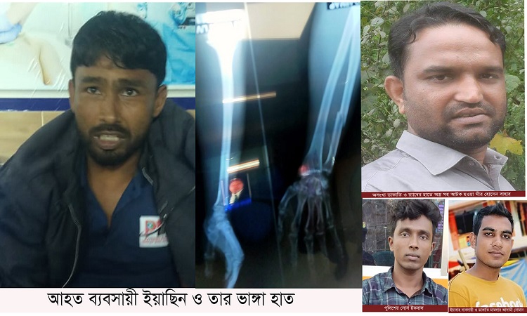 মিরসরাইয়ে ব্যবসায়ীর হাত ভেঙ্গে দিলো সন্ত্রাসীরা