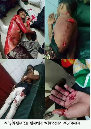আড়াইহাজারে ওয়াজ মাহফিলে ৫ কিশোরকে কুপিয়ে জখমের ঘটনায় মামলা   