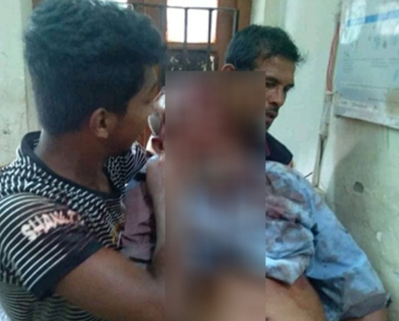 কুষ্টিয়ায় ভাগ্নের হাতুড়ির আঘাতে মামার মৃত্যু