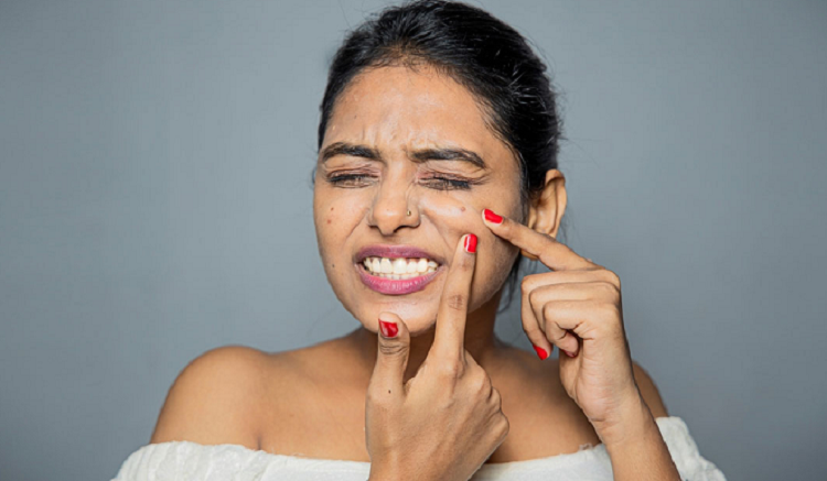 অতিরিক্ত দুশ্চিন্তায় হতে পারে ব্রণ, করণীয়