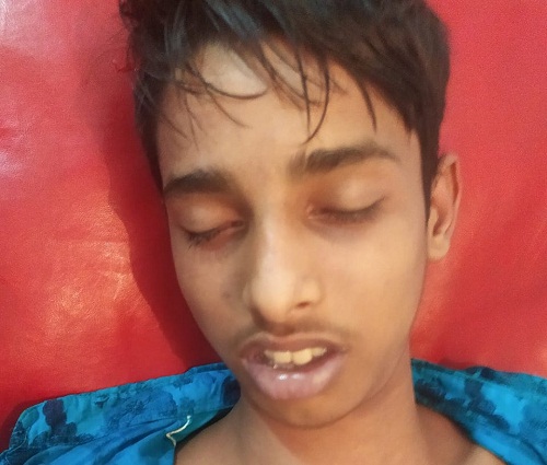 কুতুবদিয়ায় ‘বাল্ব লাগানোর’ সময় বিদ্যুৎস্পৃষ্টে শিক্ষার্থীর মৃত্যু