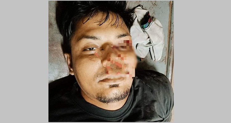 মহিপালে ঢাকা-চট্টগ্রাম মহাসড়কে দুর্ঘটনায় মোটরসাইকেল আরোহী নিহত