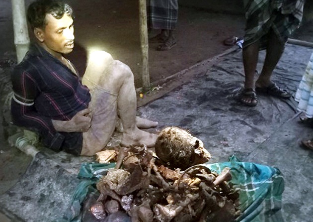 টাঙ্গাইলে বস্তাভর্তি মানুষের খুলি-হাড় সহ যুবক আটক