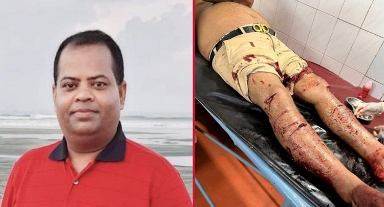 আড়াইহাজারে সাবেক ছাত্রলীগ নেতাকে কুপিয়ে জখম