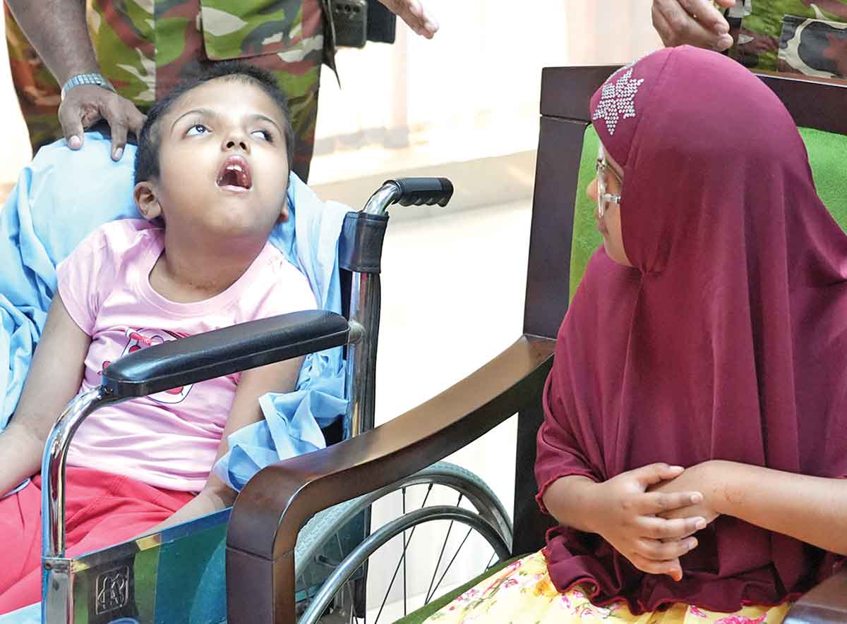 সুস্থ আছে জোড়া মাথা আলাদা করা রাবেয়া-রোকেয়া