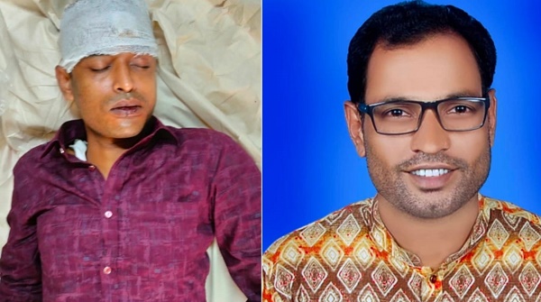 শেরপুরে উপজেলা ভাইস চেয়ারম্যানের হামলায় সাংবাদিক আহত