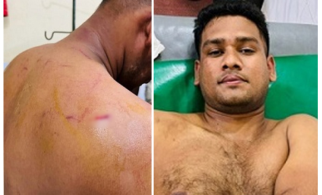 মতলবে ছাত্রদল নেতার ওপর ছাত্রলীগ সভাপতির নেতৃত্বে হামলা