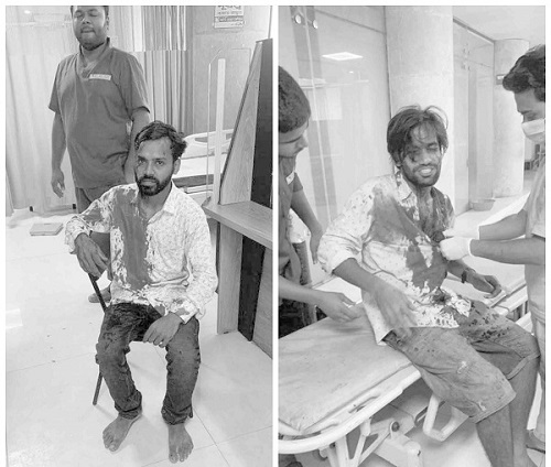 শাবি ছাত্রলীগের দুই নেতা দুর্বৃত্তের হামলা শিকার 