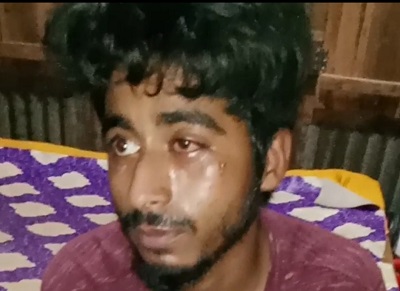 টঙ্গীবাড়ীতে পূর্ব শত্রুতার জের ধরে মা ও ছেলেকে পিটিয়ে আহত 