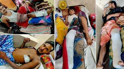 চমেক হাসপাতালে যন্ত্রণায় কাতরাচ্ছেন আহতরা