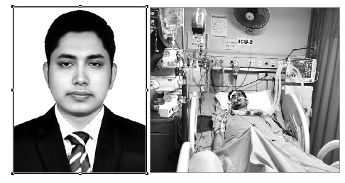 লাইফ সাপোর্টে থাকা খায়রুলের পাশে নর্থ সাউথ ইউনিভার্সিটি