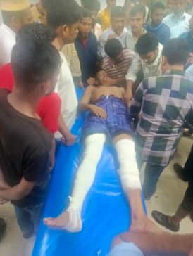 আমতলীতে যুবদল নেতাকে কুপিয়ে জখম
