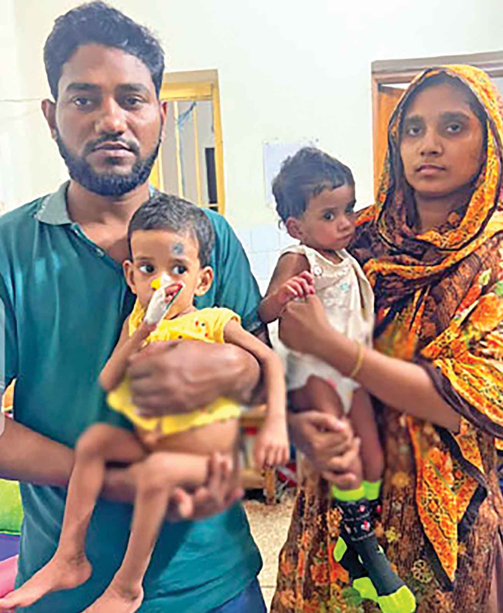 ঢামেকে আলাদা হলো যমজ শিশু শিফা-রিফা