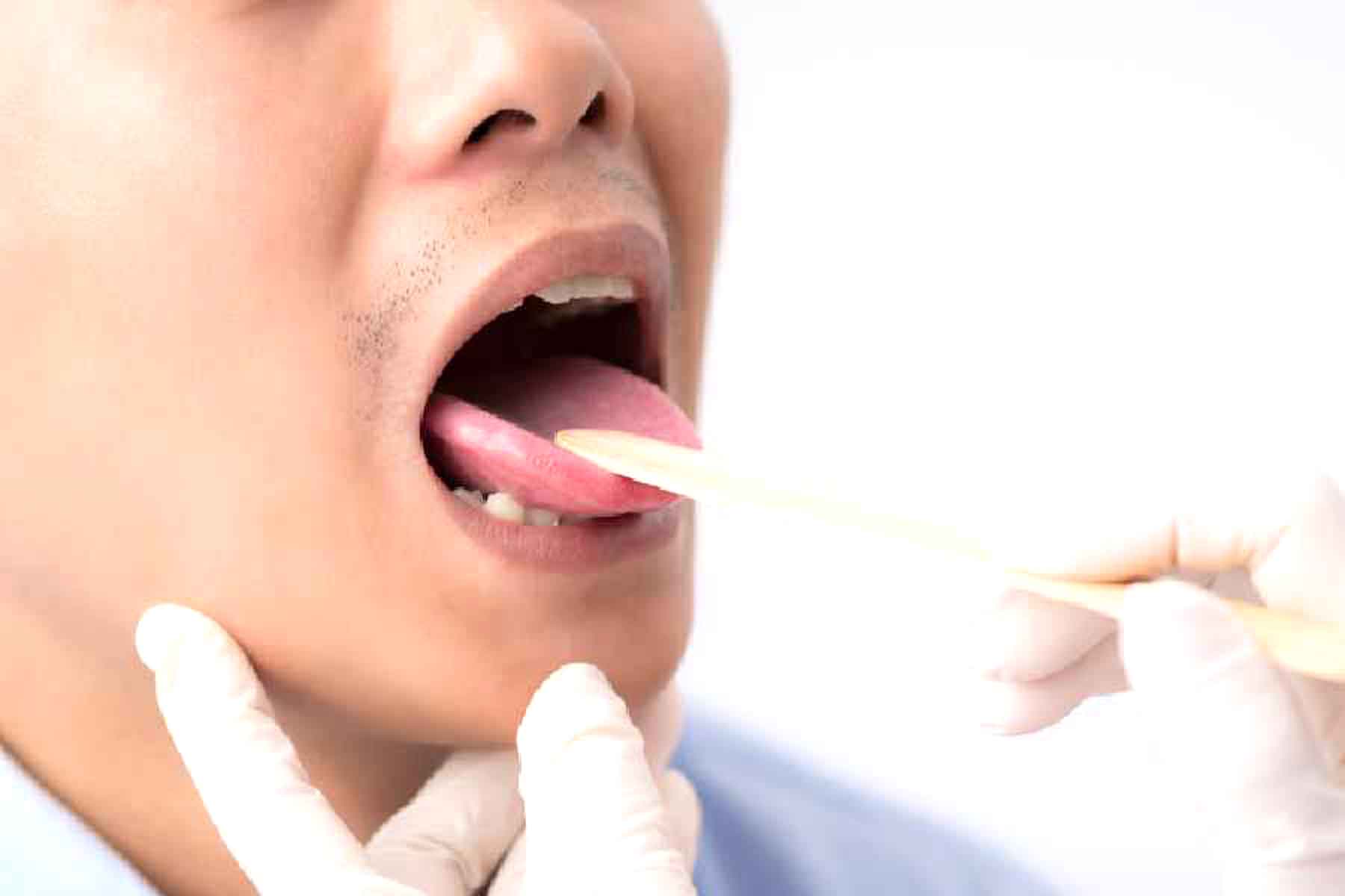 জিভ দেখে রোগ নির্ণয় করবে এআই স্ক্যানার