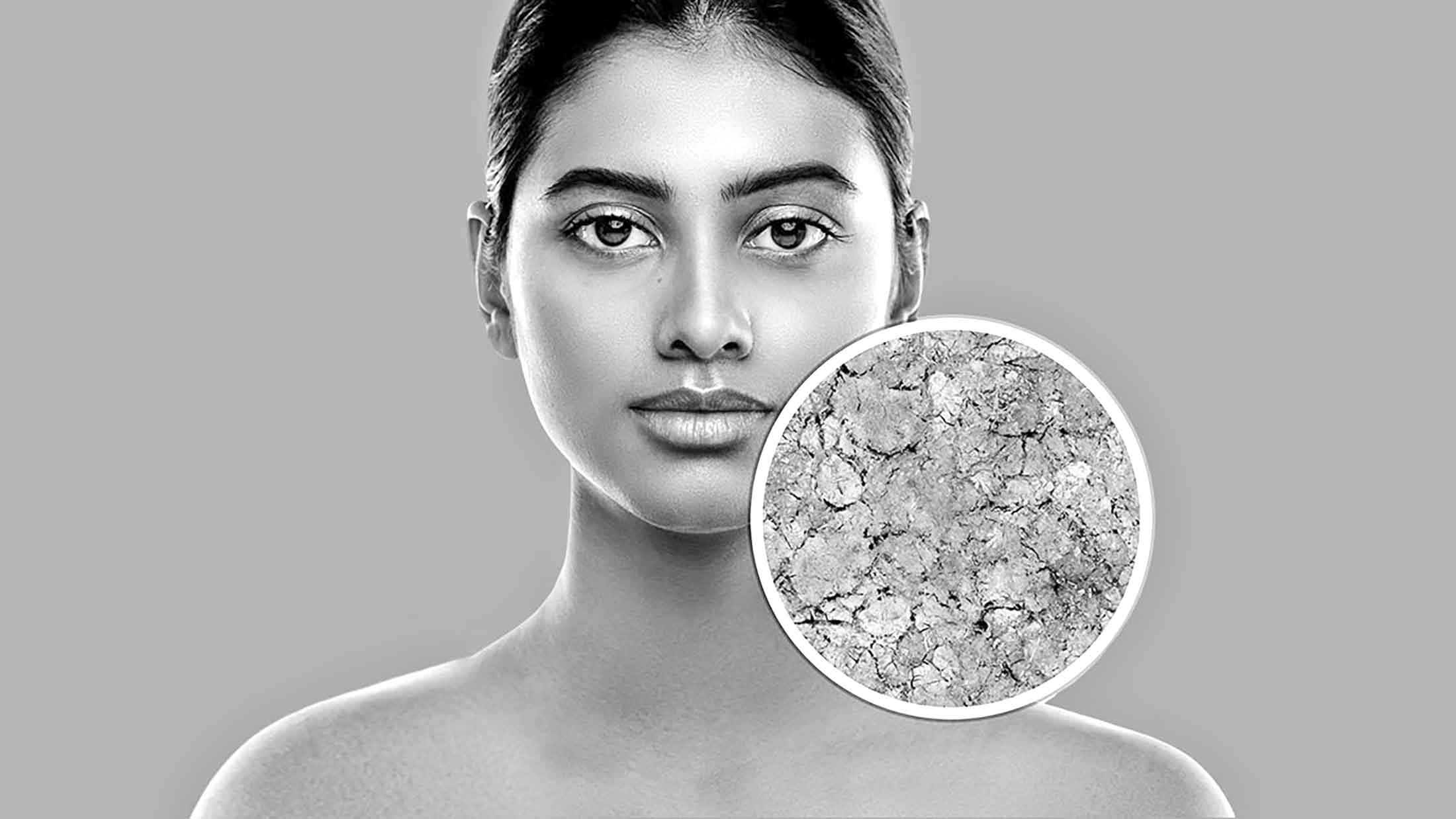 শীতের হাওয়া-ত্বকের দাওয়া