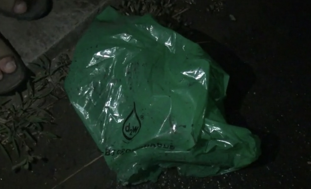 নাটোরের দত্তপাড়া থেকে মানুষের কাটা হাত উদ্ধার 