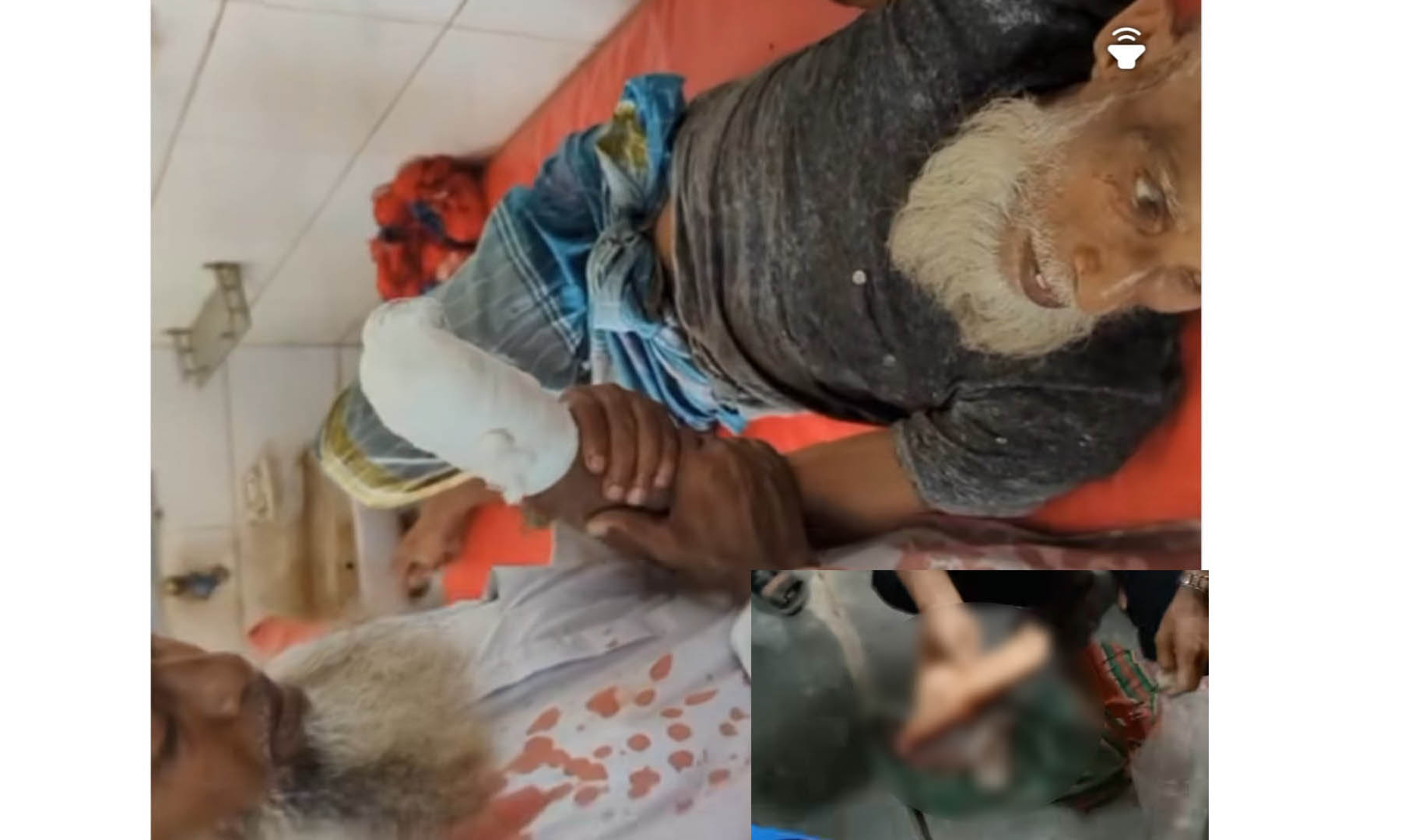 জমি নিয়ে বিরোধে কৃষকের হাতের কব্জি বিচ্ছিন্ন, আহত ৪