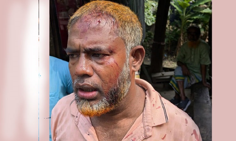 গৌরনদীতে  বিএনপি নেতাকে কুপিয়ে জখম