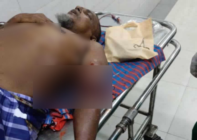 রামগঞ্জে ব্যবসায়ীকে কুপিয়ে টাকা ছিনতাই
