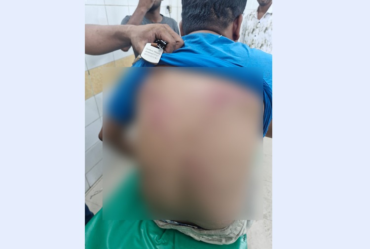 চৌদ্দগ্রামে দলীয় কোন্দলে যুবদল নেতার উপর হামলা