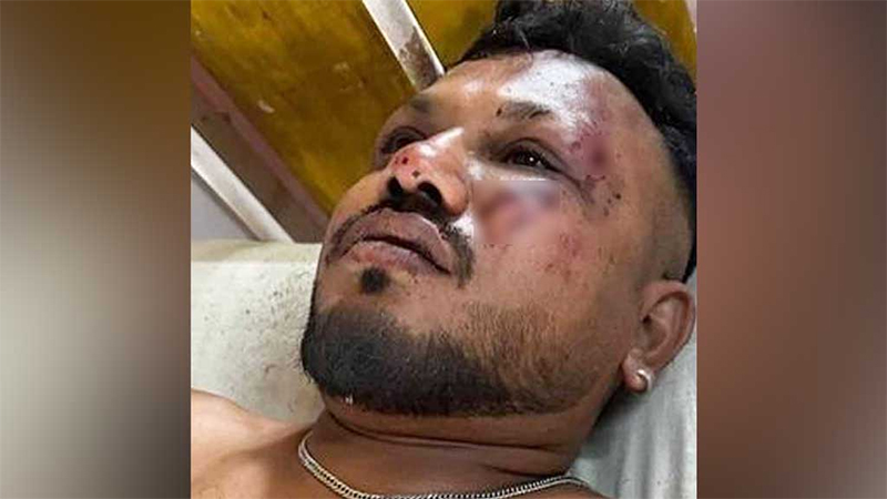 বিমান দুর্ঘটনায় অলৌকিকভাবে বেঁচে গেলেন এক যাত্রী