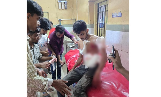 দেবিদ্বারে কিশোর গ্যাংয়ের চাপাতির কুপে কিশোর আহত