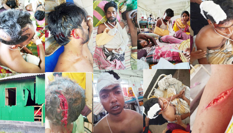 আটঘরিয়ার দুই পক্ষের মারামারি: আহত ২০, মামলা ২