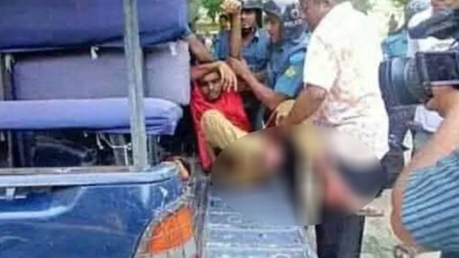 লোমহর্ষক বর্ণনা: ছাত্রলীগের হাতে পা বিচ্ছিন্ন হওয়ার কথা জানালেন রাবি শিক্ষার্থী