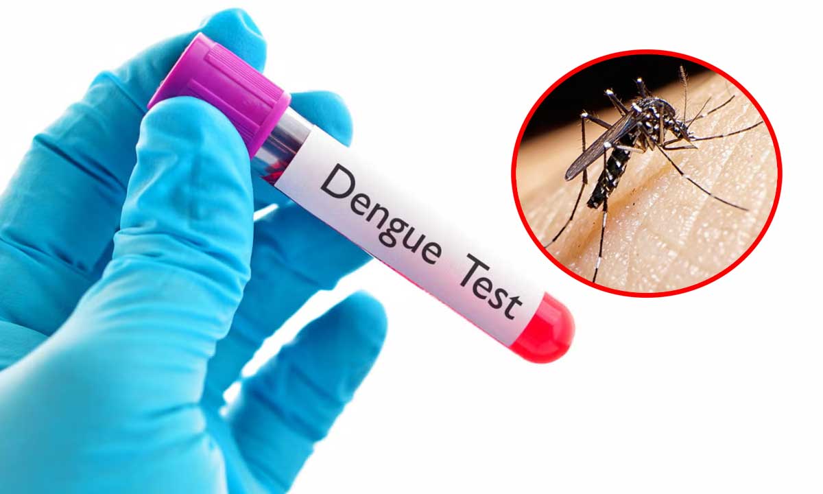 ডেঙ্গু পরীক্ষার ফি নির্ধারণ করেছে সরকার