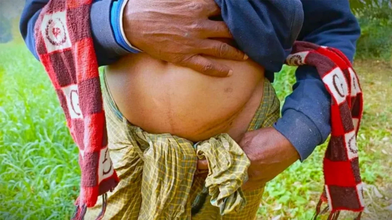 বাংলাদেশের বাইগুনি এখন ‘কিডনি বেচার গ্রাম’