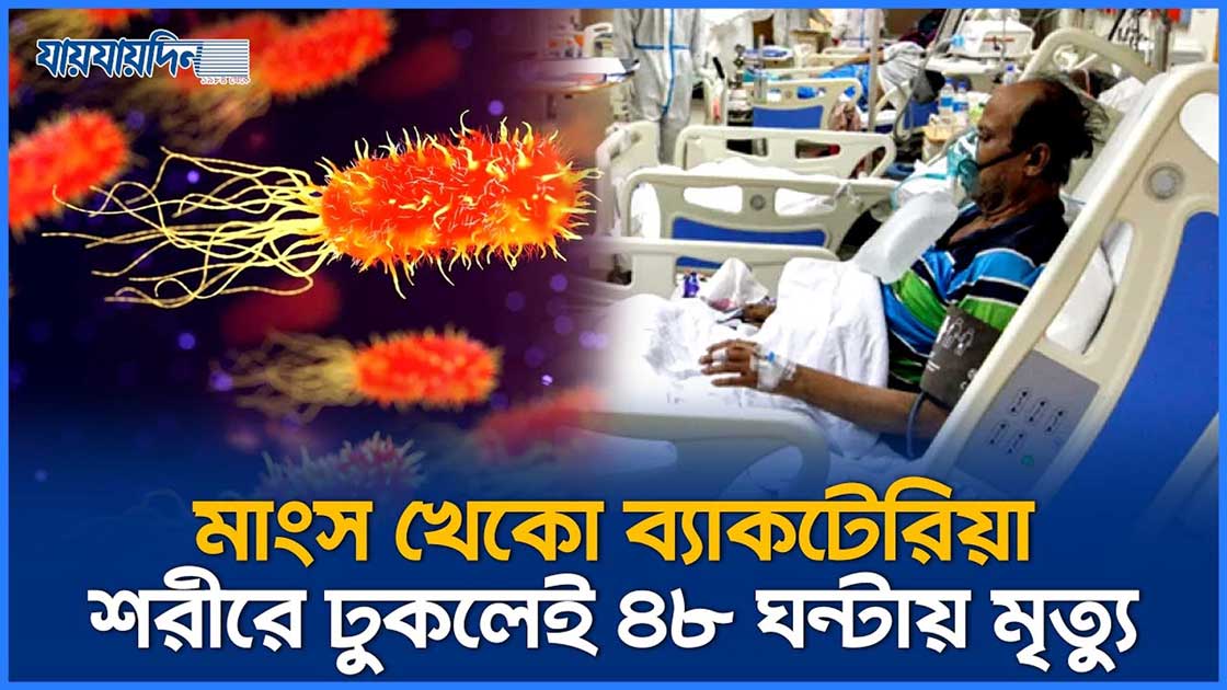 অজান্তেই শরীরে ঢুকছে মাংশ খেকো ব্যাকটেরিয়া, ৪৮ ঘন্টায় নিশ্চিত মৃত্যু