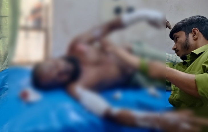 স্ত্রী না ফেরায় শ্বশুর বাড়িতেই গায়ে আগুন দিলেন স্বামী