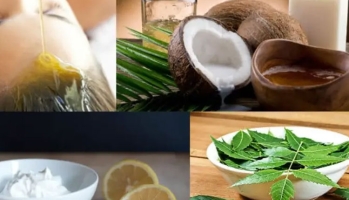 চুলের খুশকি দূর করার সহজ উপায়